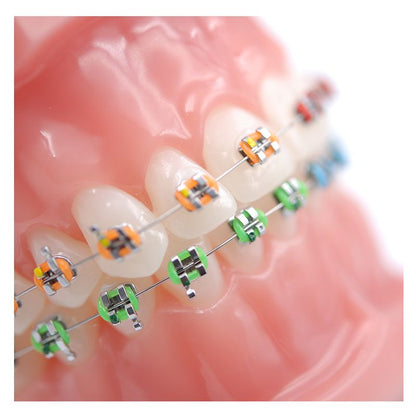Brackets Axiom Serie A