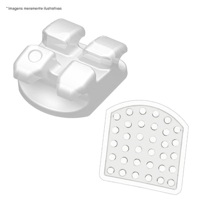 Brackets cerámicos LUCEM MBT 0.22